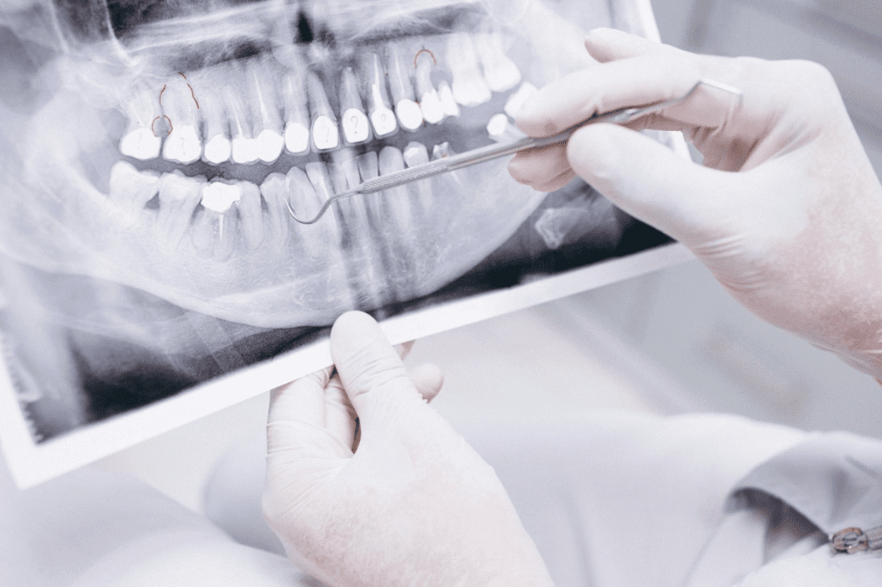 radiologie dentara